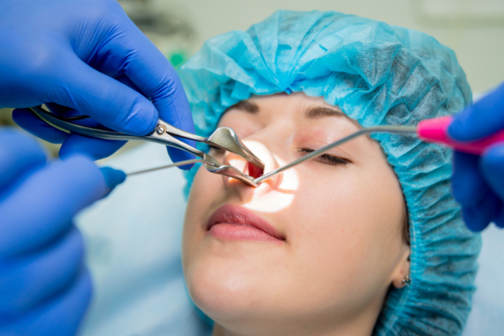 Endoscopic Nasal And Sinus Surgery​