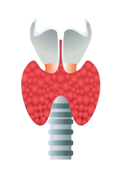 Types of THYROID SURGERY in kanpur
