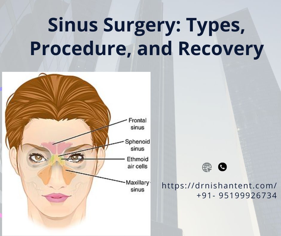 Functional Endoscopic Sinus Surgery (FESS): Procedure & Recovery