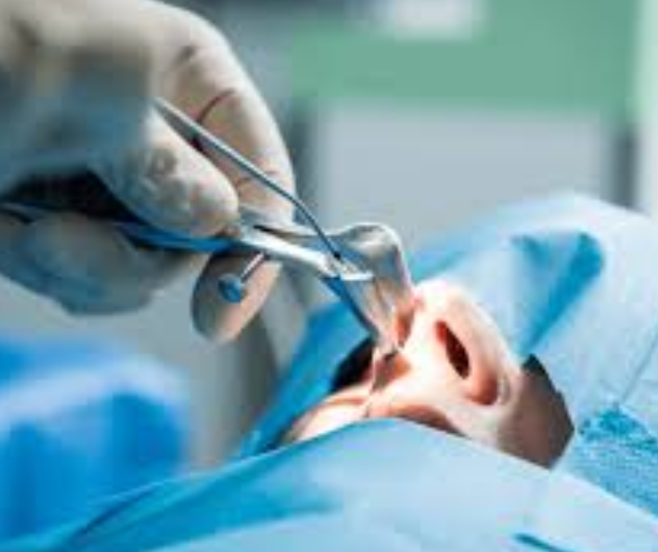nasal endoscopic surgery